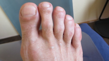 Med. Nagelpflege Med. Nagelpflege